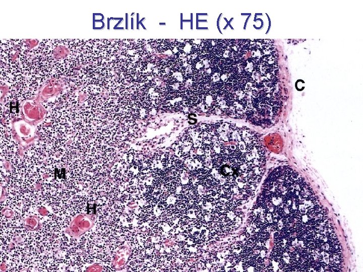 Brzlík - HE (x 75) 