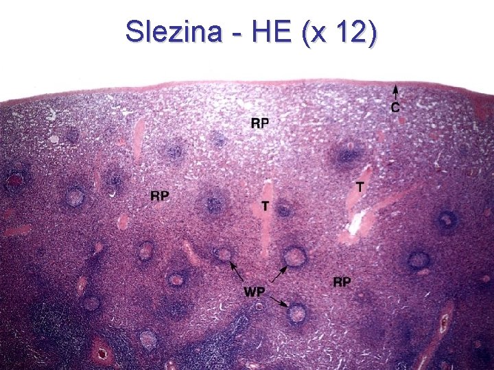 Slezina - HE (x 12) 