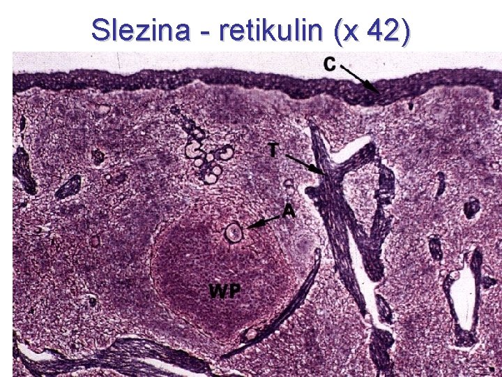 Slezina - retikulin (x 42) 