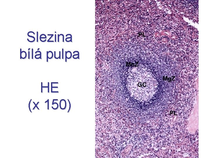 Slezina bílá pulpa HE (x 150) 