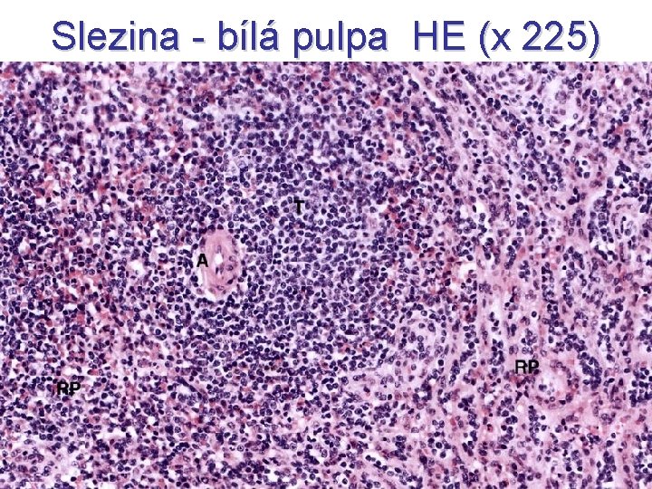 Slezina - bílá pulpa HE (x 225) 