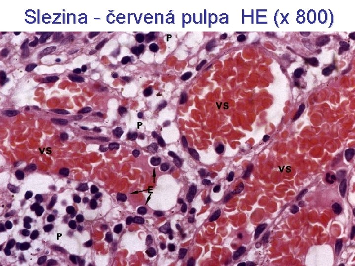 Slezina - červená pulpa HE (x 800) 