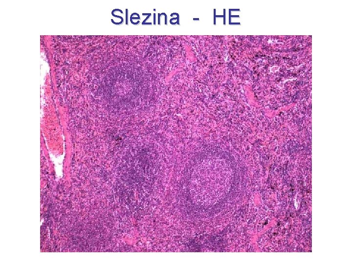 Slezina - HE 