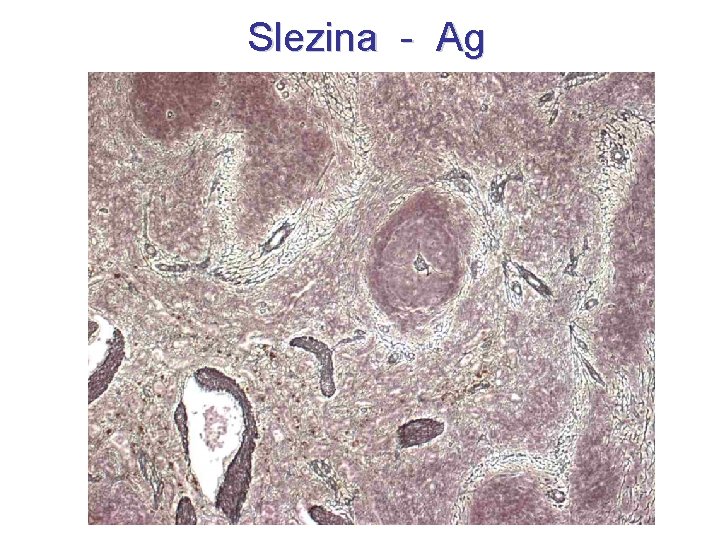 Slezina - Ag 