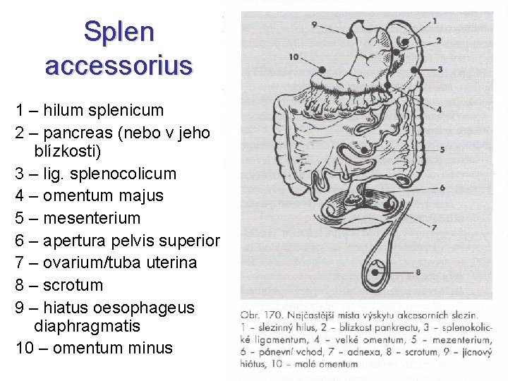 Splen accessorius 1 – hilum splenicum 2 – pancreas (nebo v jeho blízkosti) 3