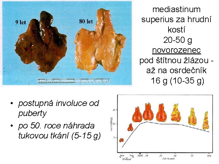 mediastinum superius za hrudní kostí 20 -50 g novorozenec pod štítnou žlázou až na