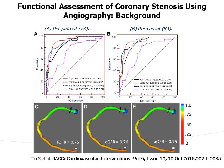 Functional Assessment of Coronary Stenosis Using Angiography: Background (A) Per patient (73). (B) Per