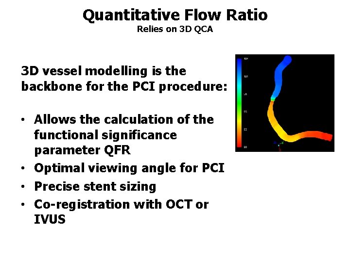 Quantitative Flow Ratio Relies on 3 D QCA 3 D vessel modelling is the