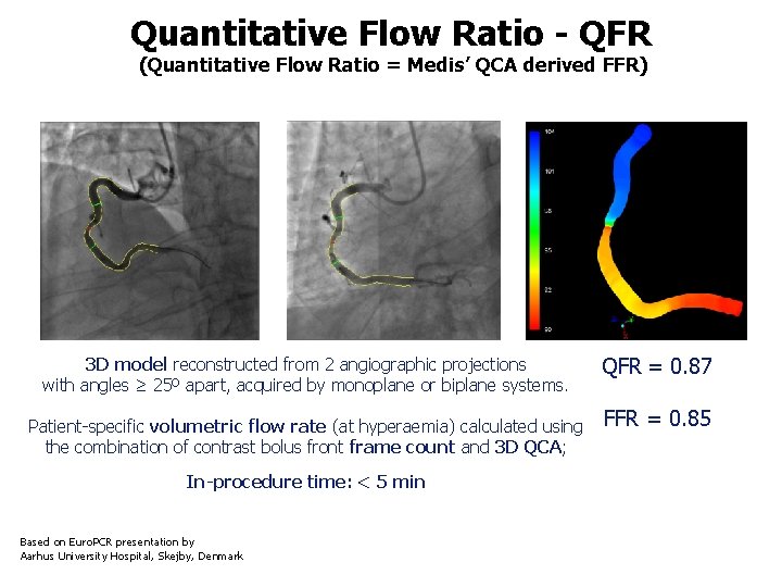 Quantitative Flow Ratio - QFR (Quantitative Flow Ratio = Medis’ QCA derived FFR) 3