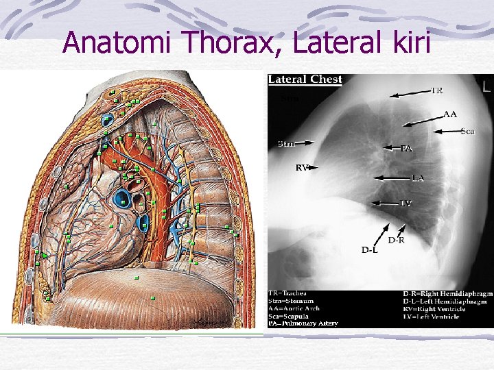 Anatomi Thorax, Lateral kiri 