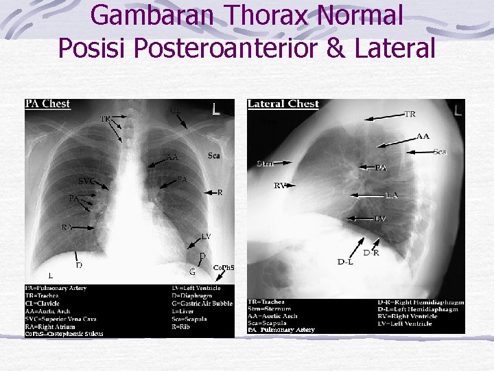 Gambaran Thorax Normal Posisi Posteroanterior & Lateral Pada Foto thorax normal, hal-hal yang perlu