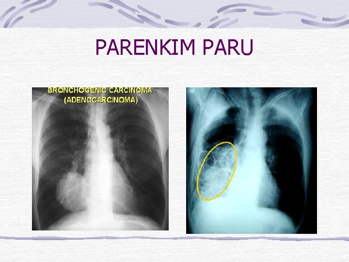 PARENKIM PARU 