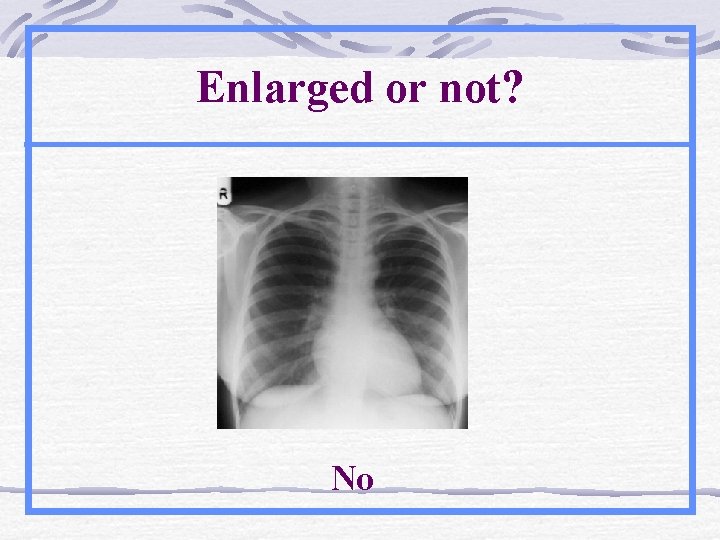Enlarged or not? No 