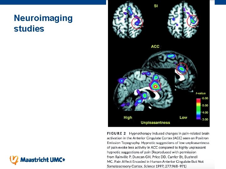 Neuroimaging studies 