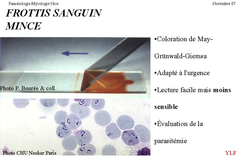 Parasitologie-Mycologie Nice Novembre 07 FROTTIS SANGUIN MINCE • Coloration de May. Grünwald-Giemsar • Adapté