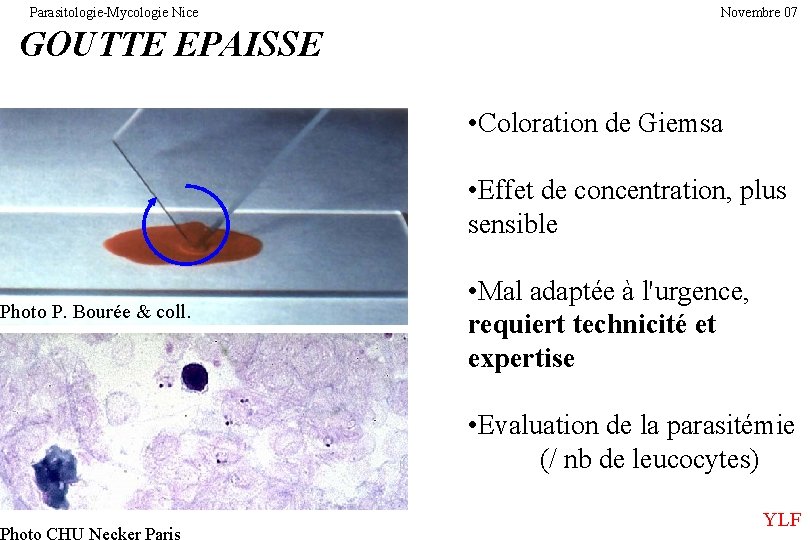 Parasitologie-Mycologie Nice Novembre 07 GOUTTE EPAISSE Photo P. Bourée & coll. Photo CHU Necker