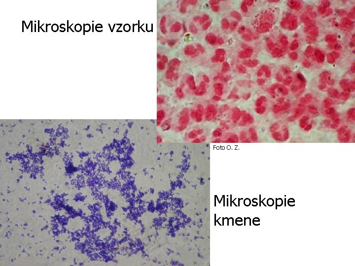 Mikroskopie vzorku Foto O. Z. Mikroskopie kmene 