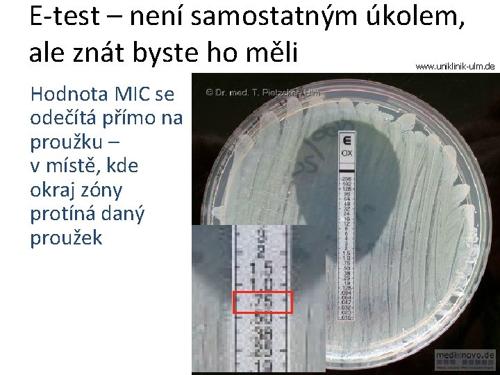 E-test – není samostatným úkolem, ale znát byste ho měli www. uniklinik-ulm. de Hodnota