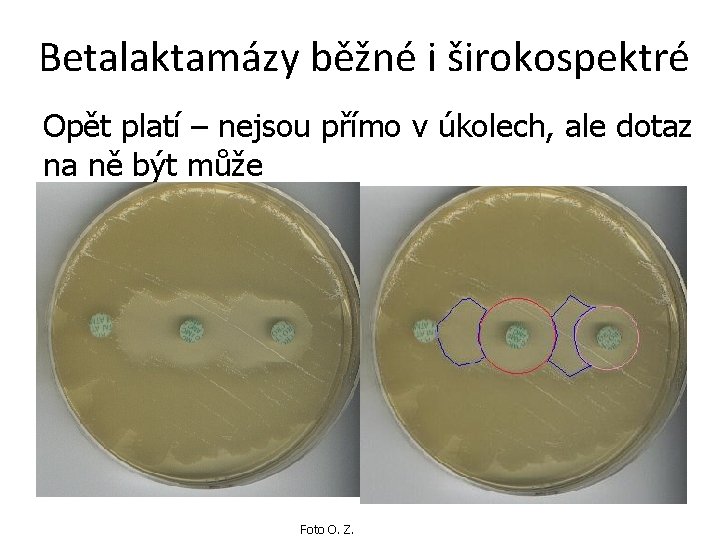 Betalaktamázy běžné i širokospektré Opět platí – nejsou přímo v úkolech, ale dotaz na