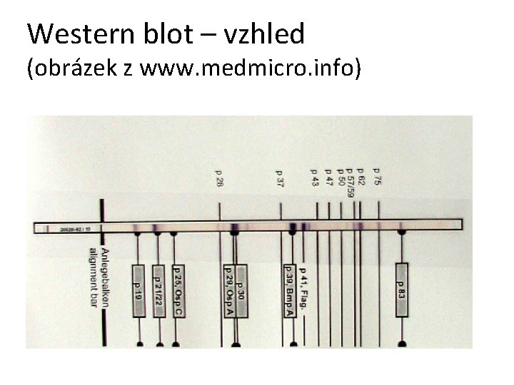 Western blot – vzhled (obrázek z www. medmicro. info) 