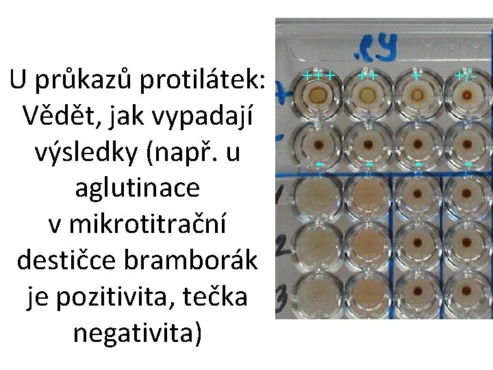 U průkazů protilátek: Vědět, jak vypadají výsledky (např. u aglutinace v mikrotitrační destičce bramborák