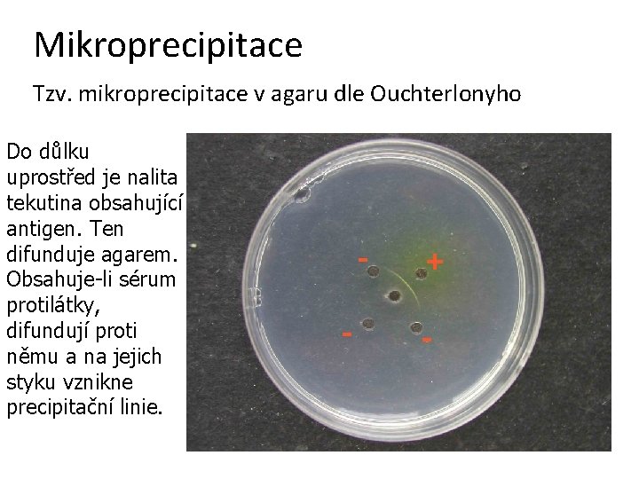 Mikroprecipitace Tzv. mikroprecipitace v agaru dle Ouchterlonyho Do důlku uprostřed je nalita tekutina obsahující
