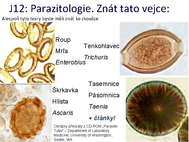 J 12: Parazitologie. Znát tato vejce: Alespoň tyto tvary byste měli znát ke zkoušce