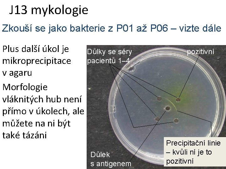 J 13 mykologie Zkouší se jako bakterie z P 01 až P 06 –