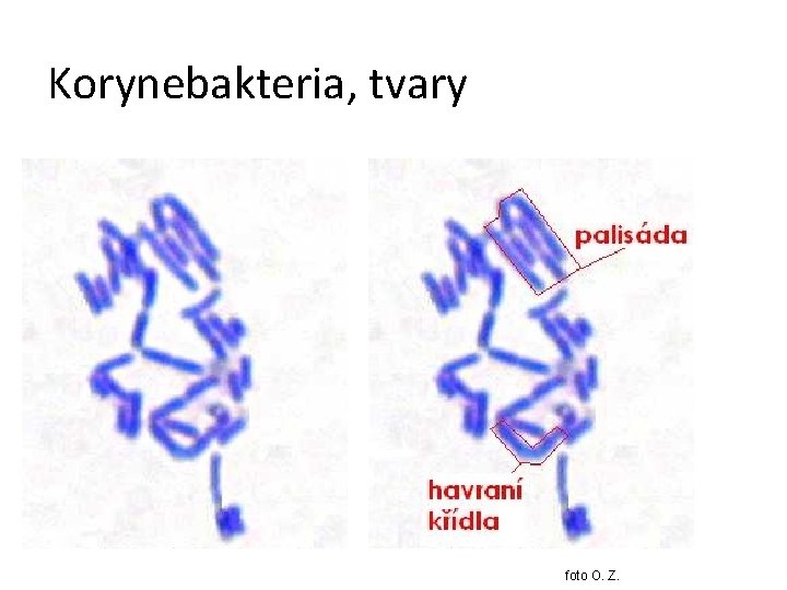 Korynebakteria, tvary foto O. Z. 