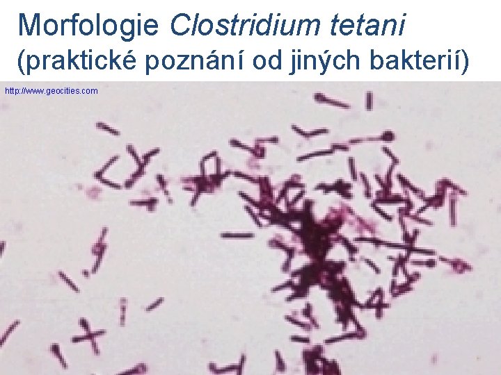 Morfologie Clostridium tetani (praktické poznání od jiných bakterií) http: //www. geocities. com 
