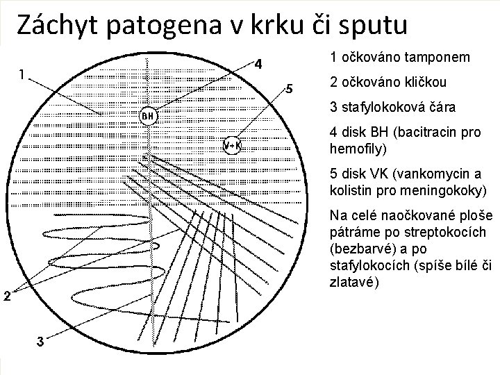 Záchyt patogena v krku či sputu 1 očkováno tamponem 2 očkováno kličkou 3 stafylokoková