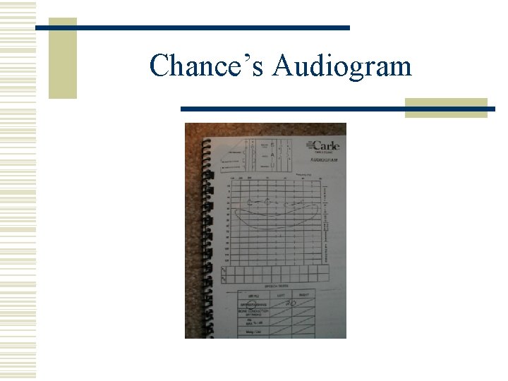 Chance’s Audiogram 