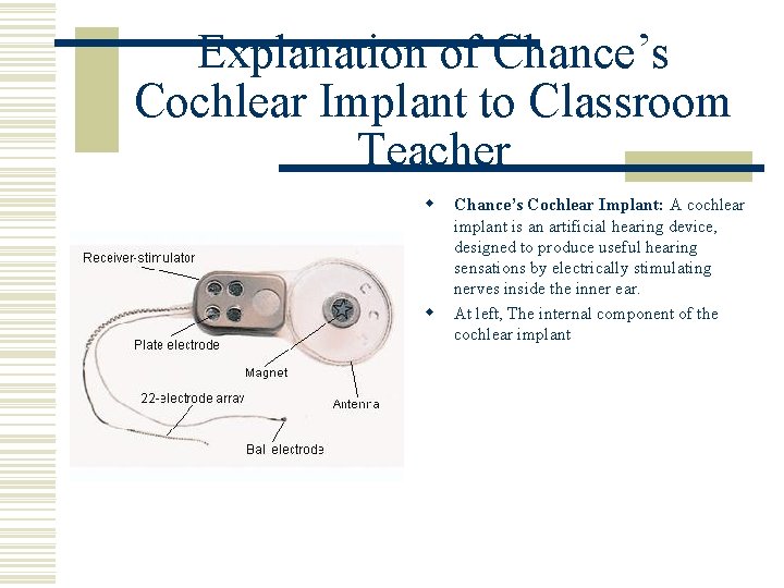 Explanation of Chance’s Cochlear Implant to Classroom Teacher w w Chance’s Cochlear Implant: A