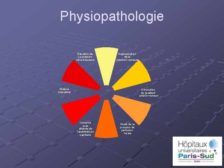 Physiopathologie Élévation de La pression intra-tissulaire Augmentation de la pression veineuse Œdème interstitiel Diminution