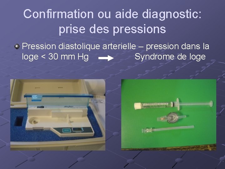 Confirmation ou aide diagnostic: prise des pressions Pression diastolique arterielle – pression dans la