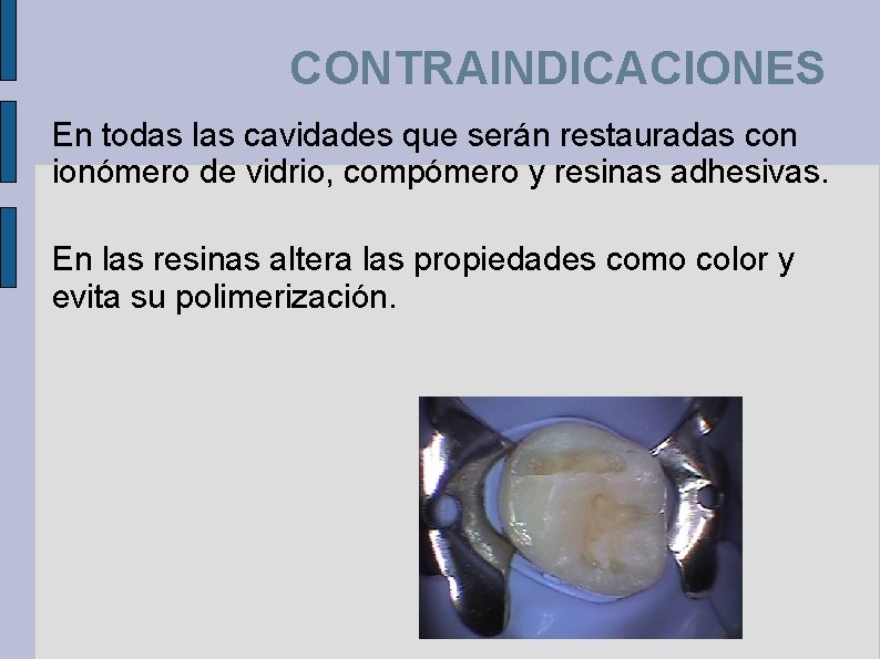 CONTRAINDICACIONES En todas las cavidades que serán restauradas con ionómero de vidrio, compómero y