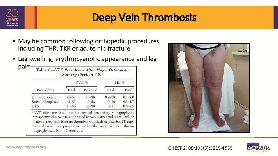 Deep Vein Thrombosis • May be common following orthopedic procedures including THR, TKR or