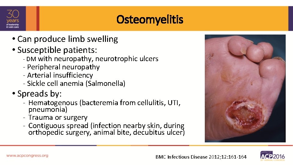 Osteomyelitis • Can produce limb swelling • Susceptible patients: - DM with neuropathy, neurotrophic