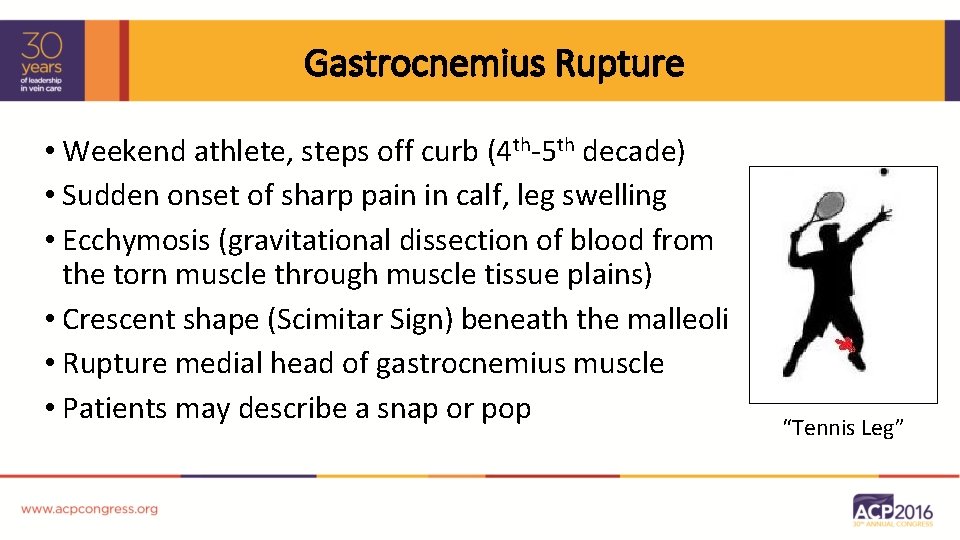 Gastrocnemius Rupture • Weekend athlete, steps off curb (4 th-5 th decade) • Sudden