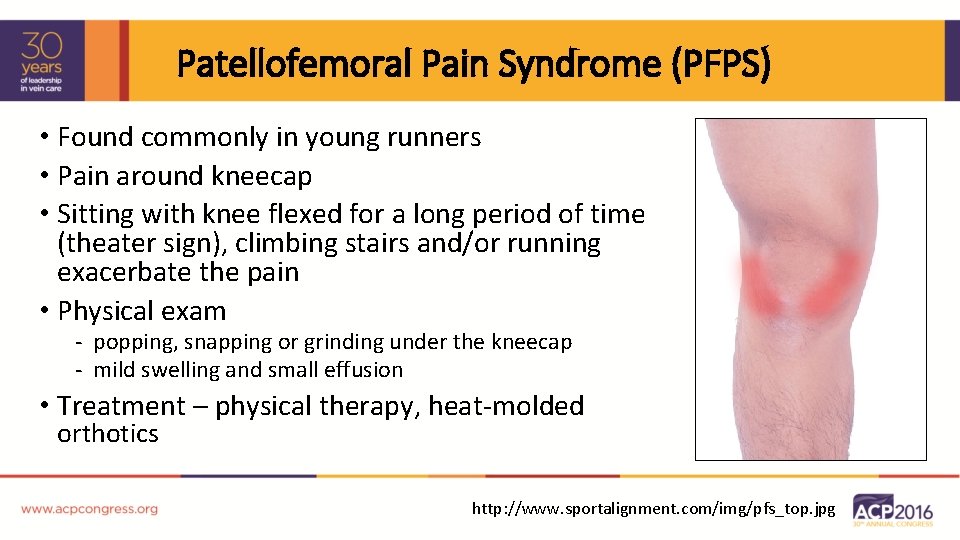 Patellofemoral Pain Syndrome (PFPS) • Found commonly in young runners • Pain around kneecap