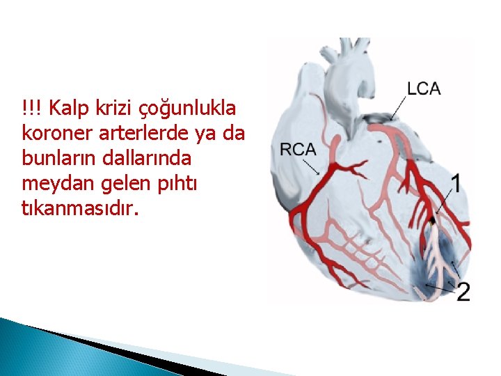 !!! Kalp krizi çoğunlukla koroner arterlerde ya da bunların dallarında meydan gelen pıhtı tıkanmasıdır.