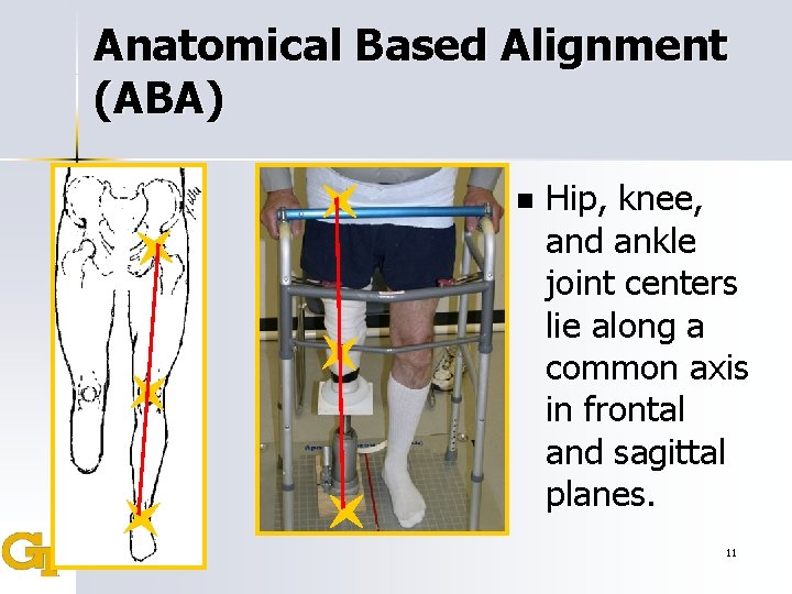 Anatomical Based Alignment (ABA) n Hip, knee, and ankle joint centers lie along a