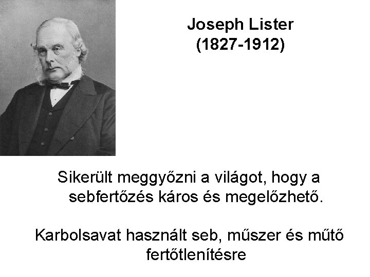 Joseph Lister (1827 -1912) Sikerült meggyőzni a világot, hogy a sebfertőzés káros és megelőzhető.