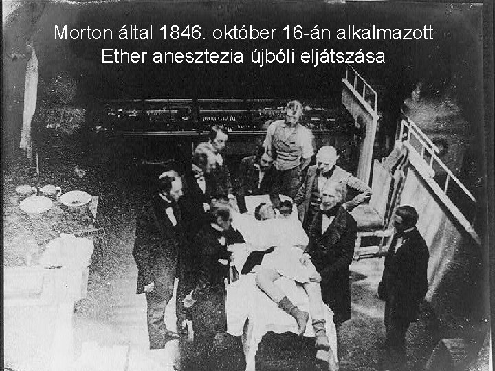 Morton által 1846. október 16 -án alkalmazott Ether anesztezia újbóli eljátszása 