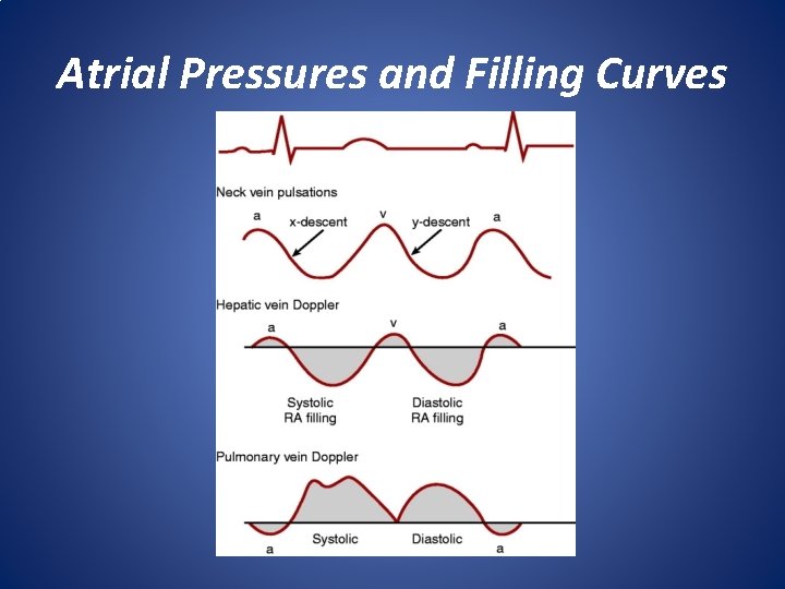 Atrial Pressures and Filling Curves 