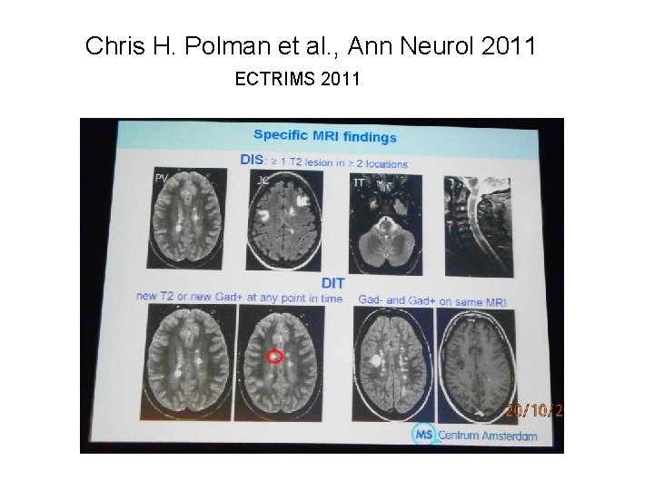  Chris H. Polman et al. , Ann Neurol 2011 ECTRIMS 2011 