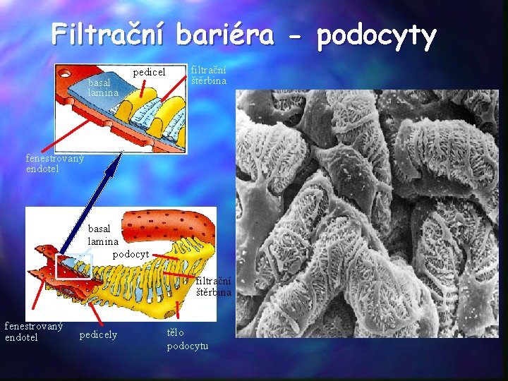 Filtrační bariéra - podocyty basal lamina pedicel filtrační štěrbina fenestrovaný endotel basal lamina podocyt