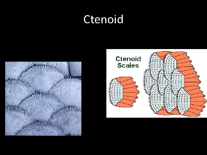 Ctenoid 