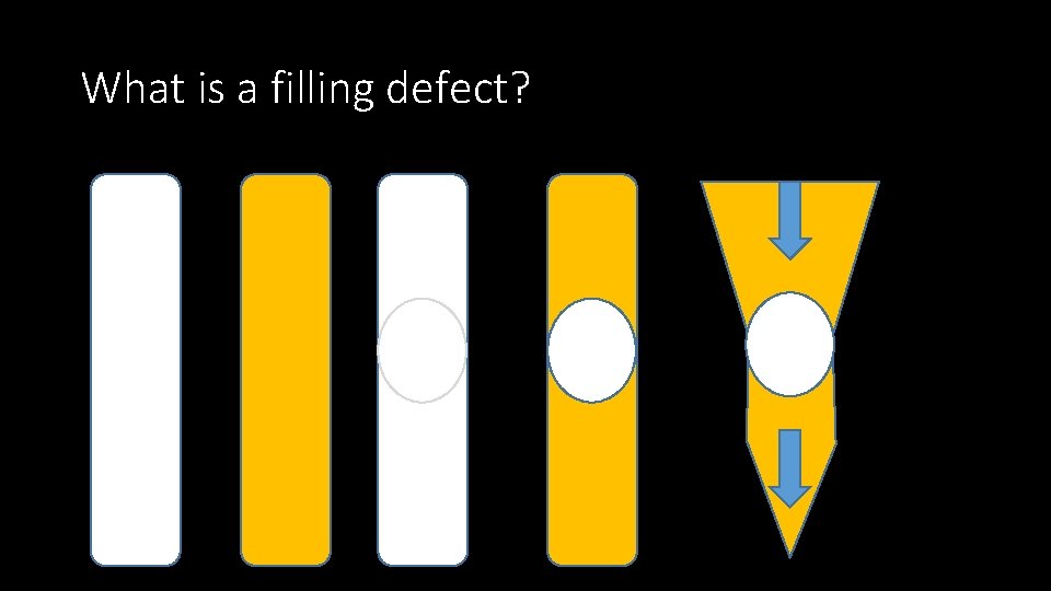 What is a filling defect? 
