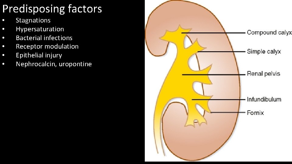 Predisposing factors • • • Stagnations Hypersaturation Bacterial infections Receptor modulation Epithelial injury Nephrocalcin,